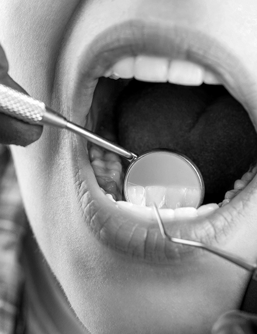 Dentisterie esthétique